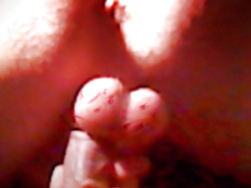 8P SPANKED BALLS