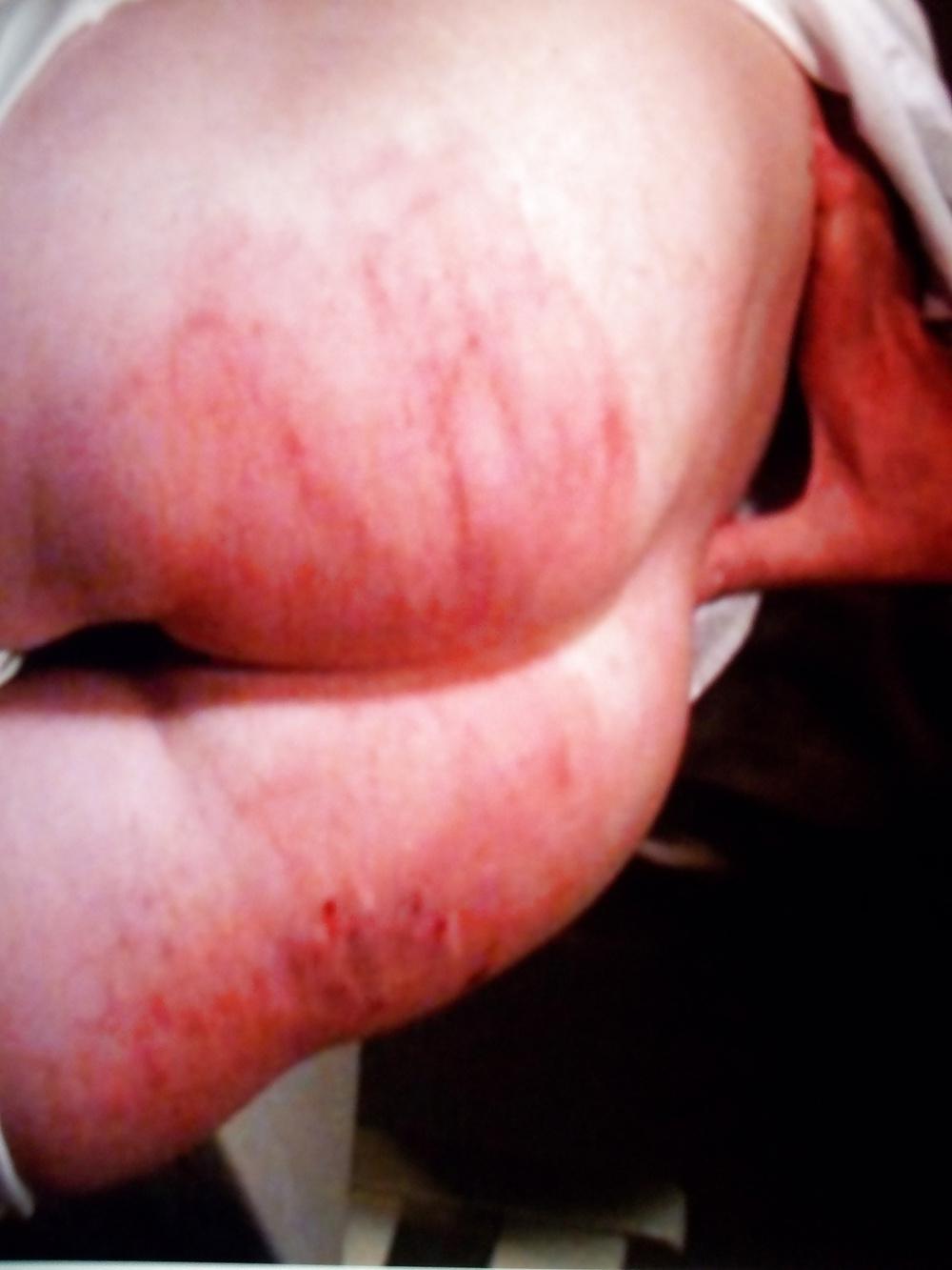 8P SPANKED BALLS