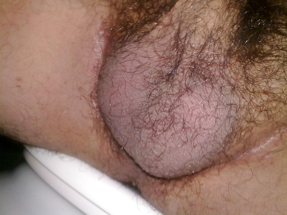 4P About my balls