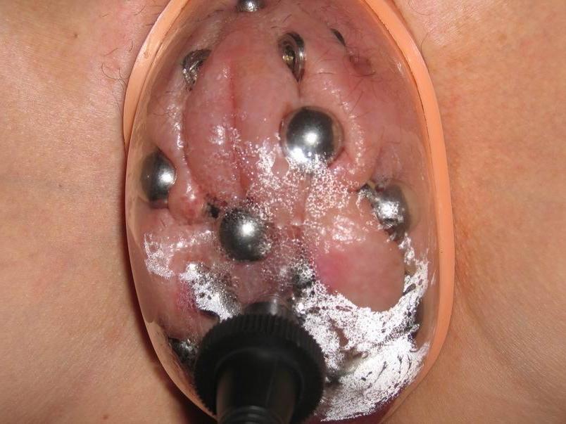 12P extreme pumped and swollen female private parts