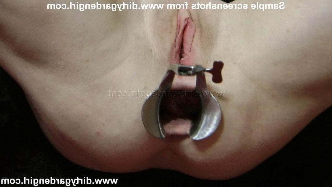 15P extreme prolapse fisting speculum plays
