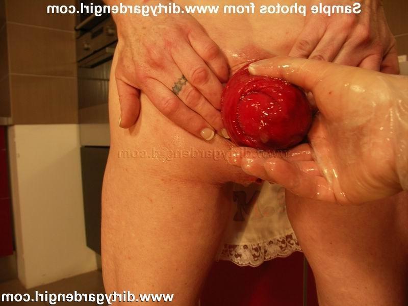 15P Extreme prolapse pumping