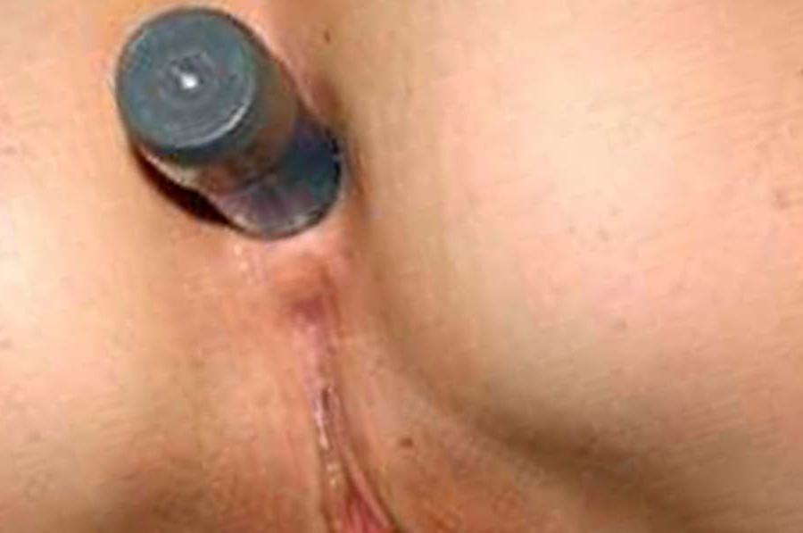 15P Hot and amazing photo library of sleazy amateur sluts fucked in the ass