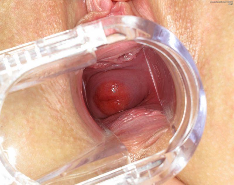 16P Pussy closeups with speculum and dildo ass playing