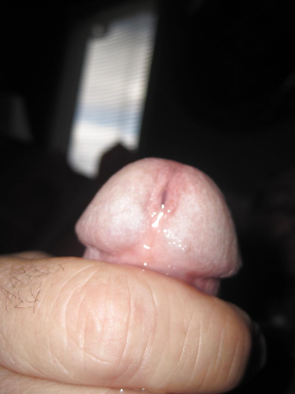 12P Gestreckte Eier, tropfendes Sperma