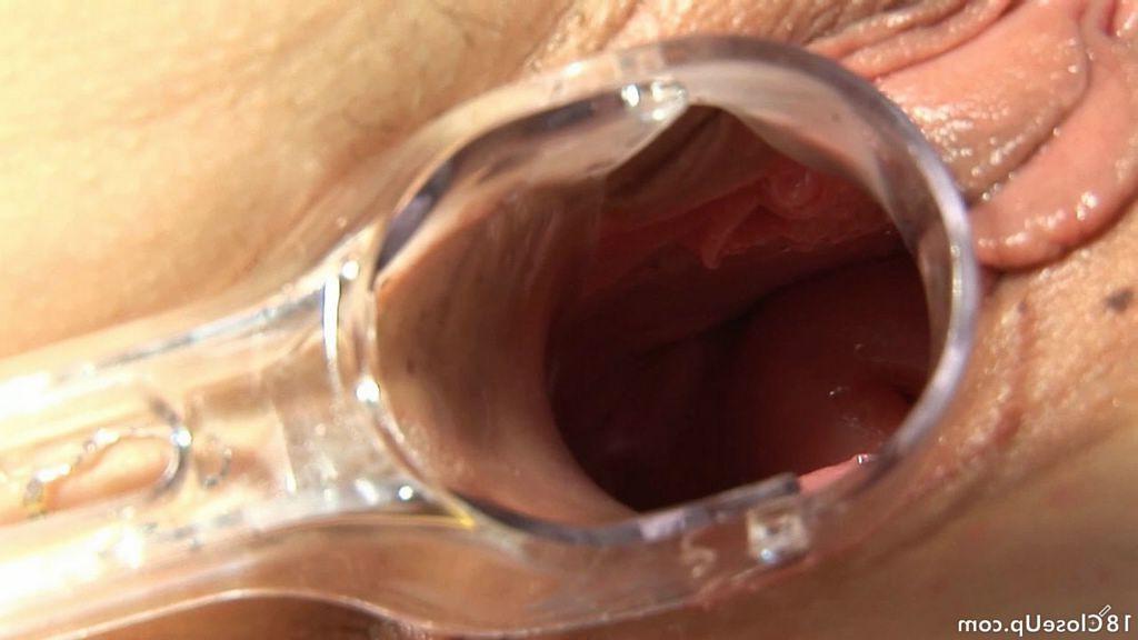 18P Teen pussy closeups with toys and speculum spreads