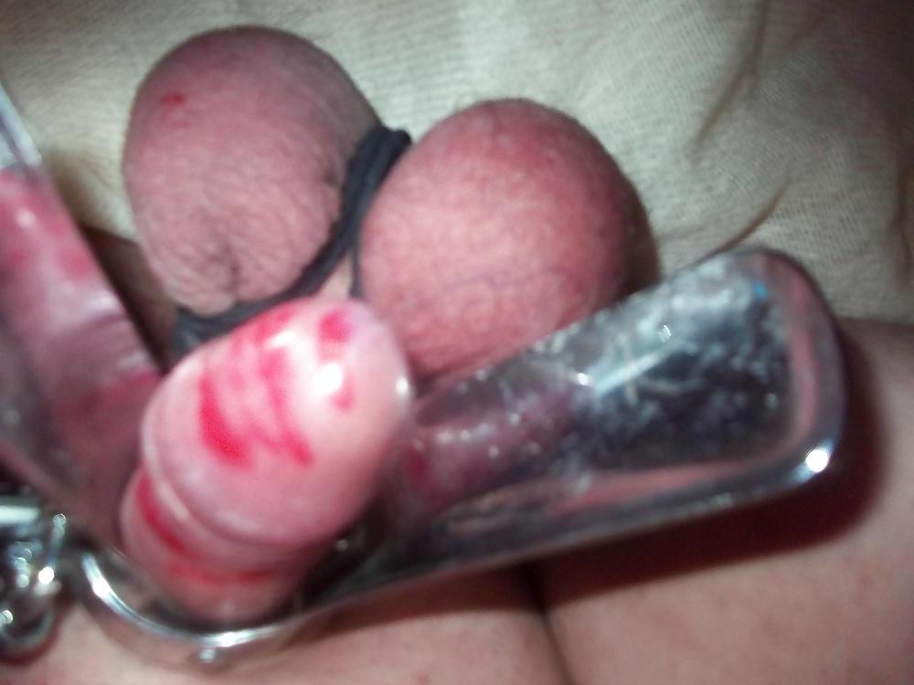 9P BALLS
