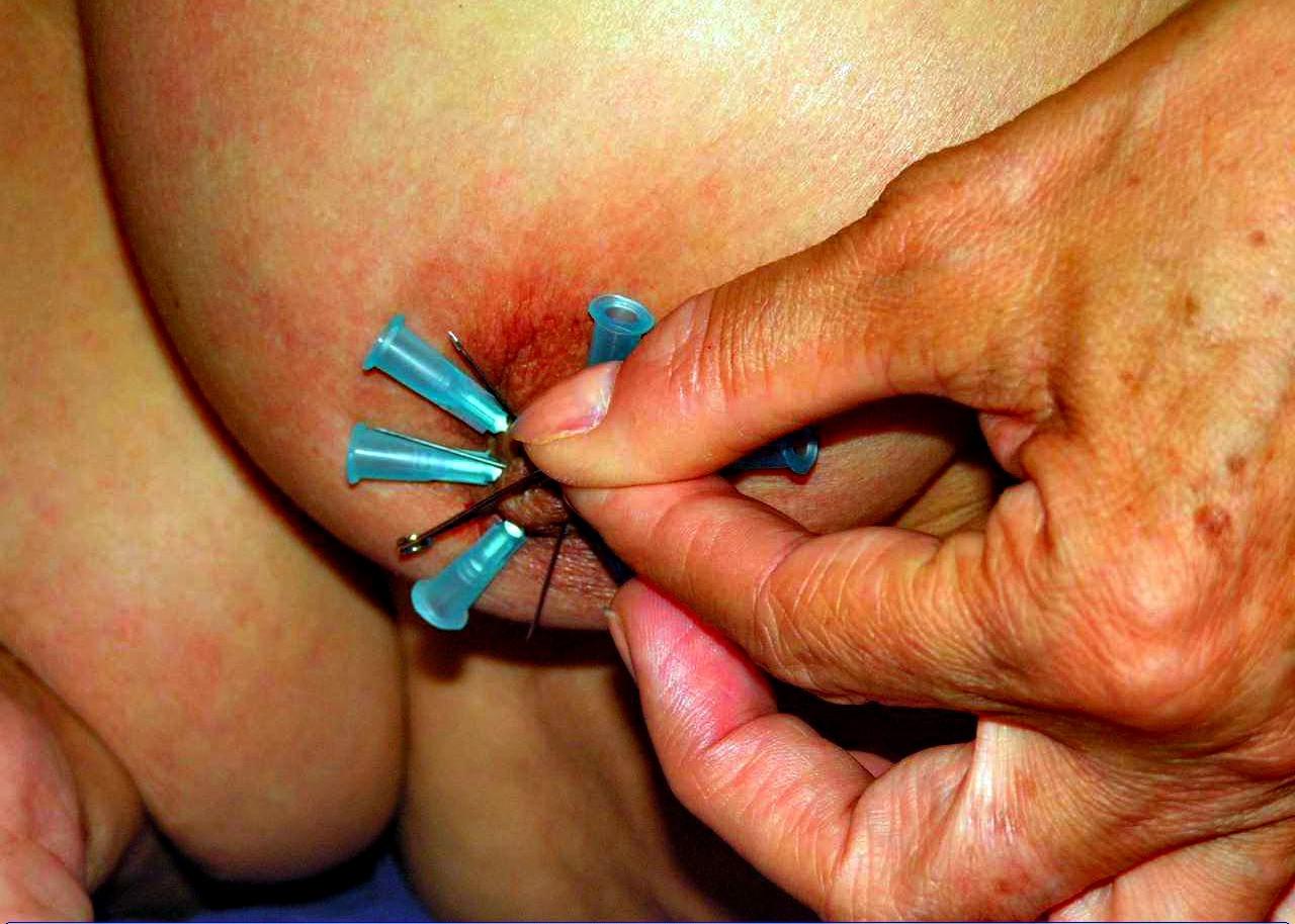 16P Amateur tit torture and extreme bdsm of ebony slave girl in needle punishments a