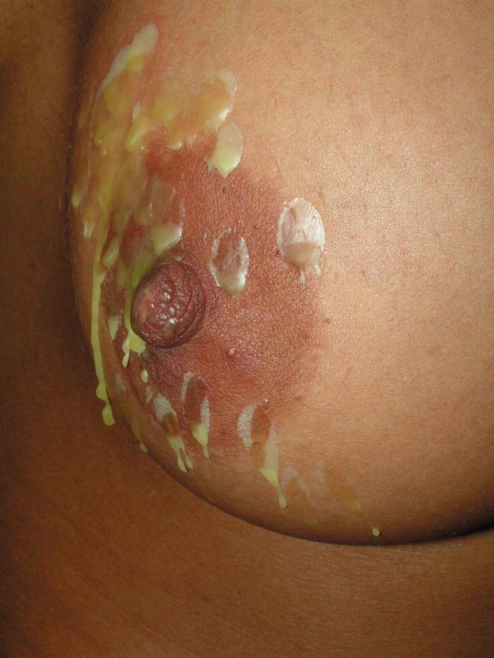 16P Slavegirls extreme breast torments and needle pain