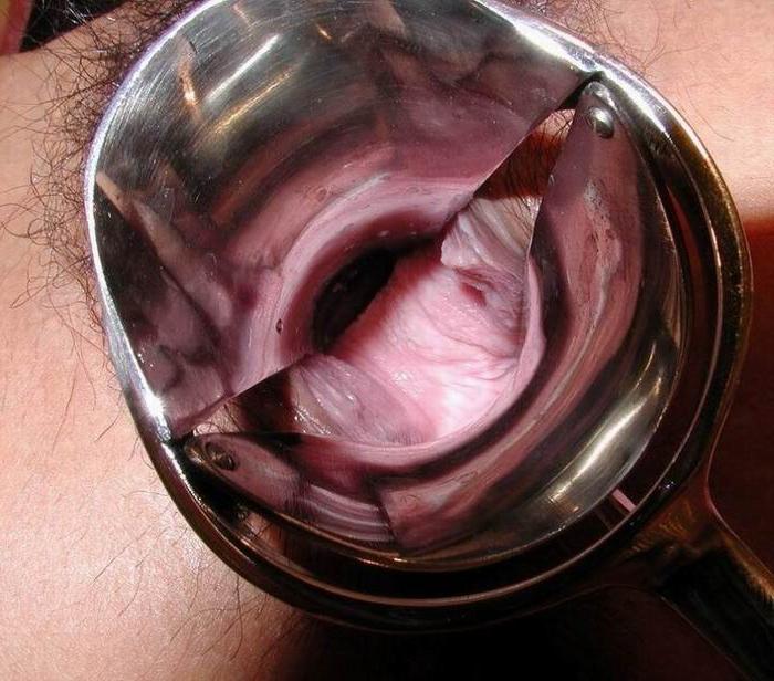16P vaginal speculum and objects insertions