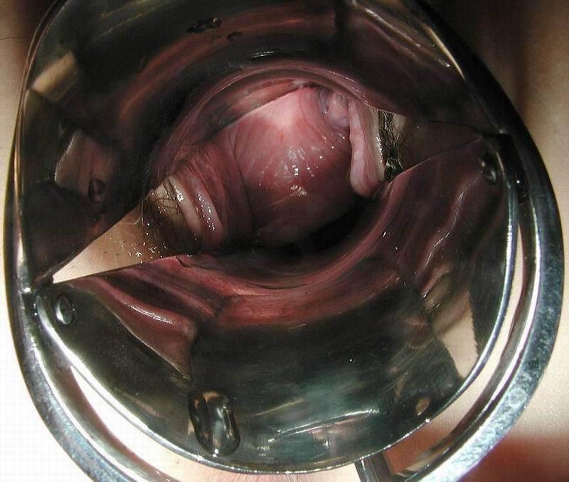 16P vaginal speculum and objects insertions