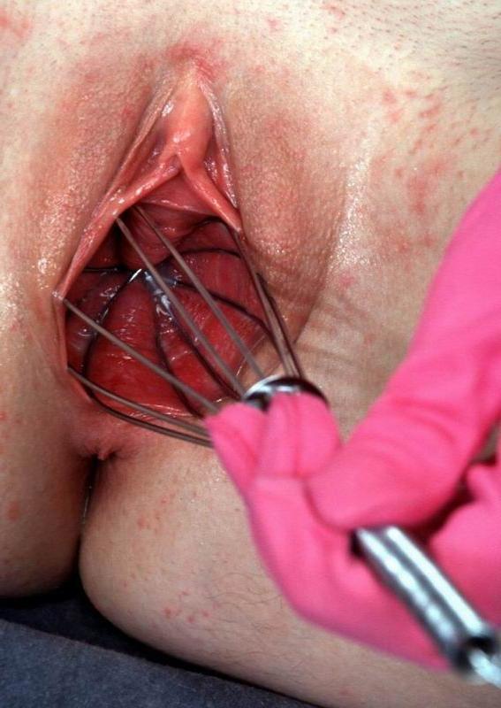 16P extreme pussy and anal insertions