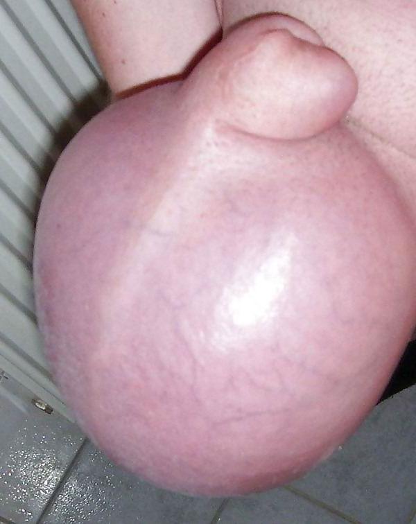 16P guy showing his huge saline balls