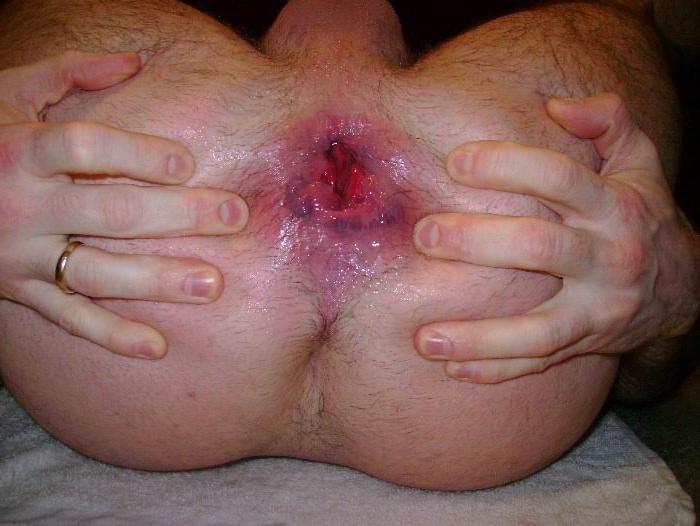 15P extreme pussy and anal fisting action