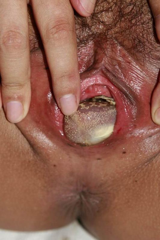 15P extreme pussy and anal fisting action