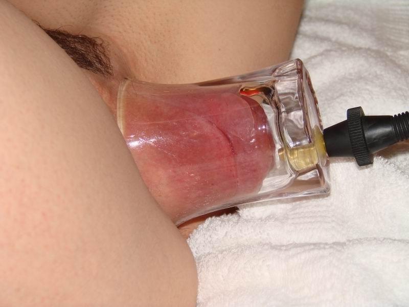 11P Extreme pumping