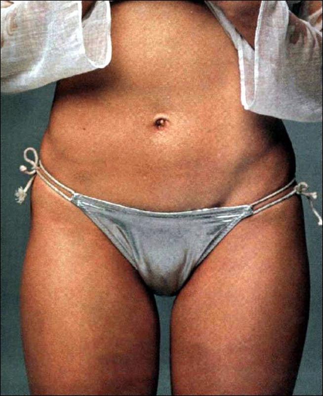 15P Celebrity Cameron Diaz shoing exposed perky tits