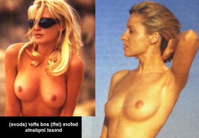 15P Scandal celebrity Dannii Minogue totally nude body
