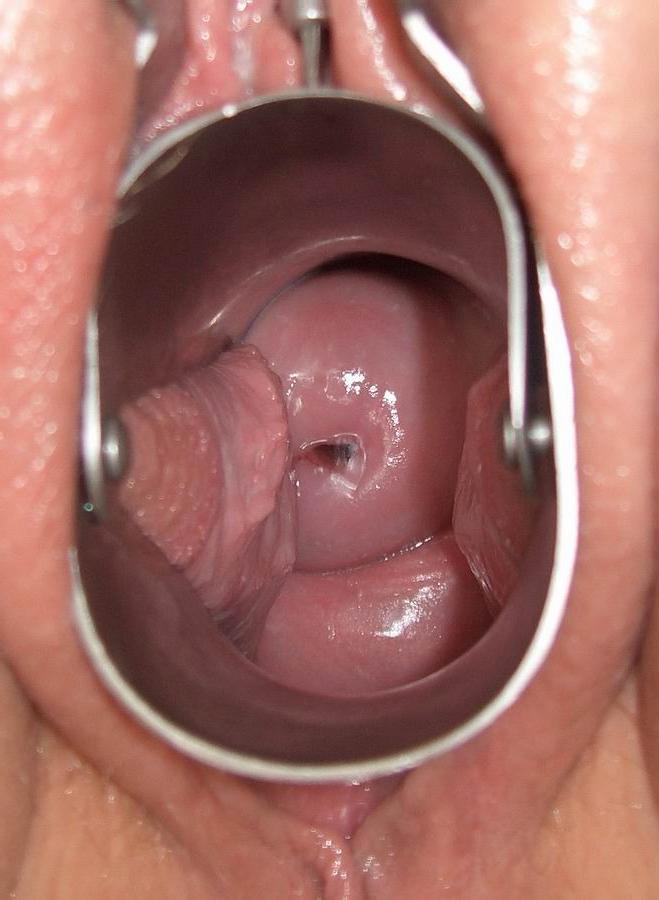 15P extreme speculum insertions