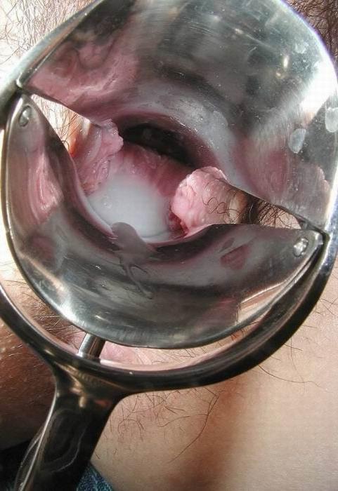 15P extreme speculum insertions