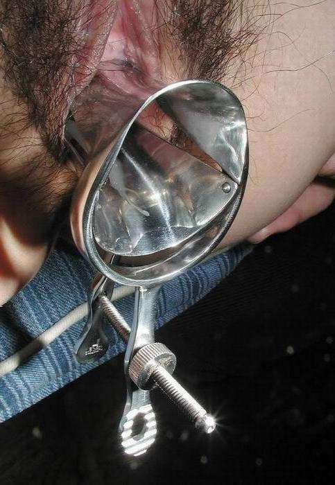 15P extreme speculum insertions