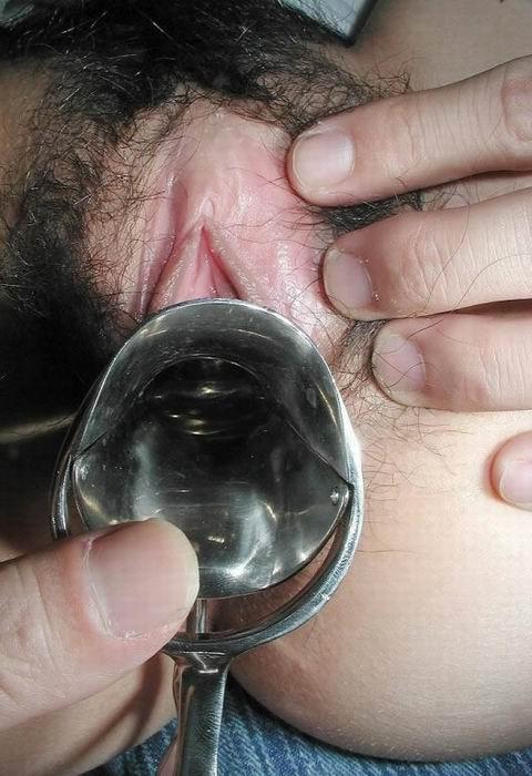 15P extreme speculum insertions