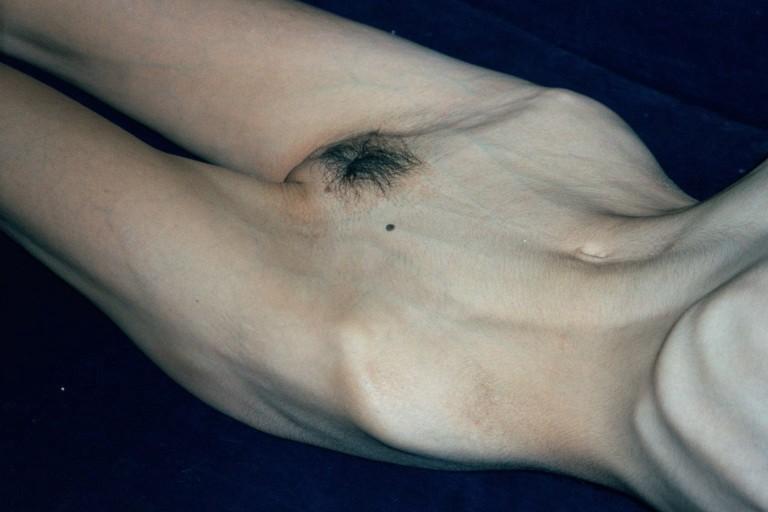 12P amateur anorexic girls posing and in action