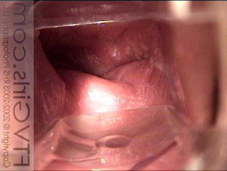 22P Redhead swallowing marbles with pussy