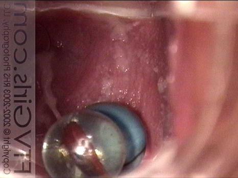 22P Redhead swallowing marbles with pussy