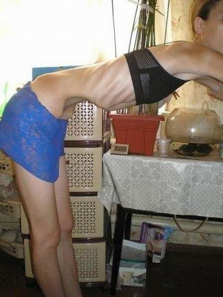 15P skinny anorexic girls posing and in action