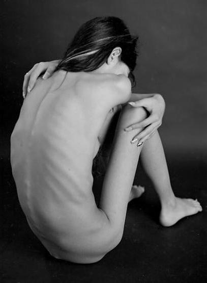 15P skinny anorexic girls posing and in action