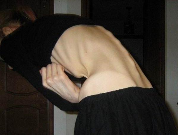 12P extremely skinny girls posing and in action