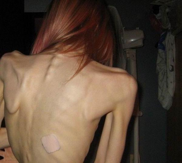 12P extremely skinny girls posing and in action