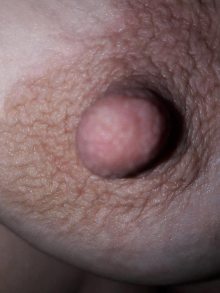 25P Big nipples