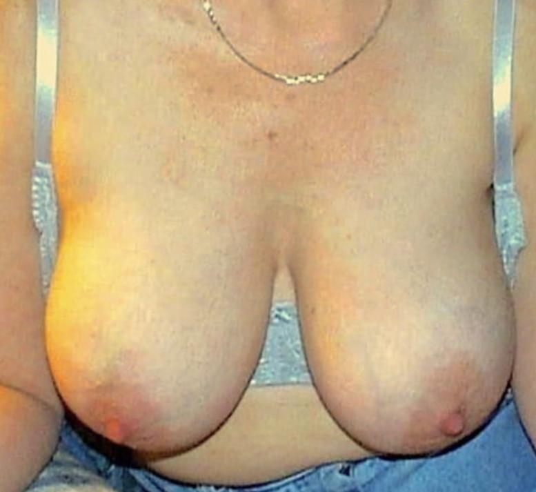 25P Big Saggy Tits
