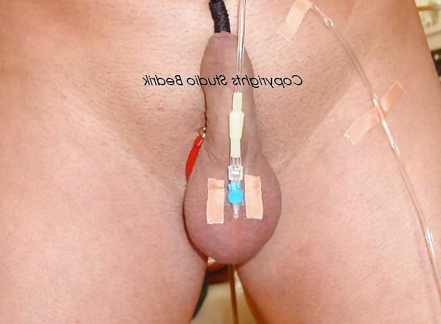 9P Saline Balls 2.0 l by Bedrik