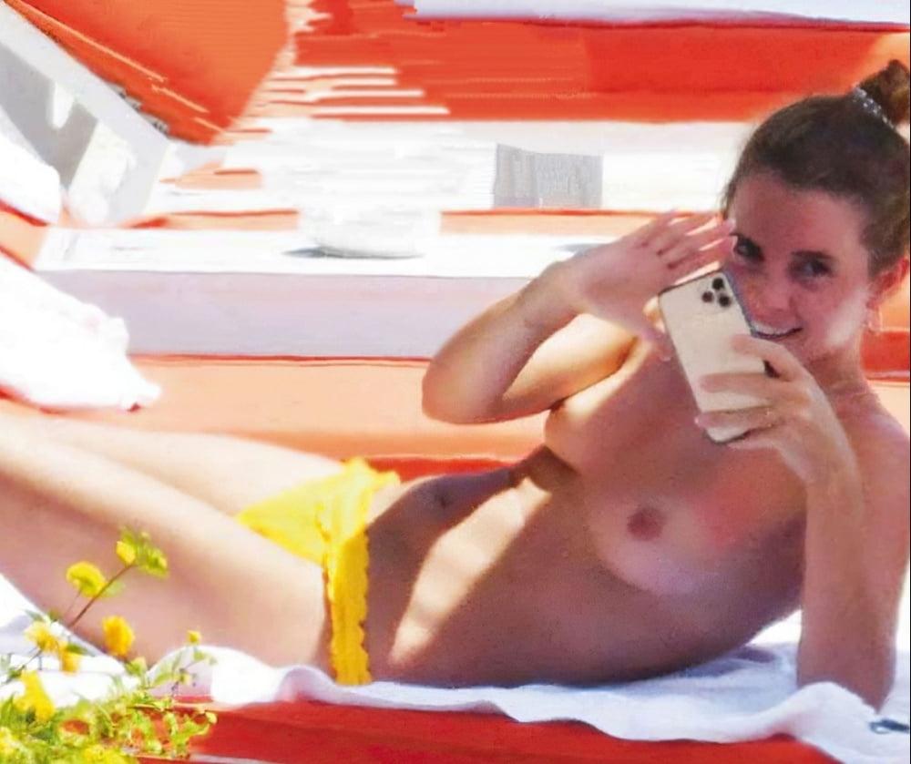 25P Italian topless 2020