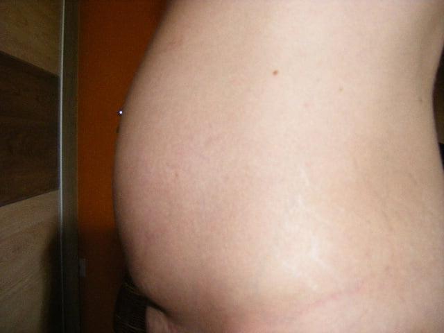 20P pregnant slut exposed for everyone