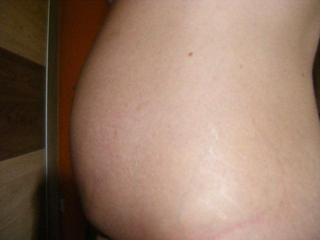 20P pregnant slut exposed for everyone