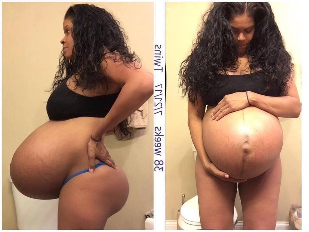 25P pregnant