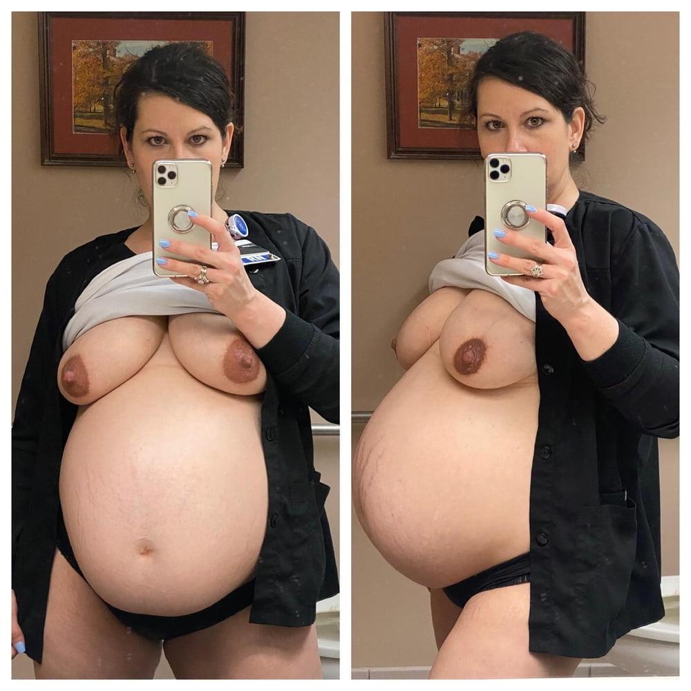 25P pregnant