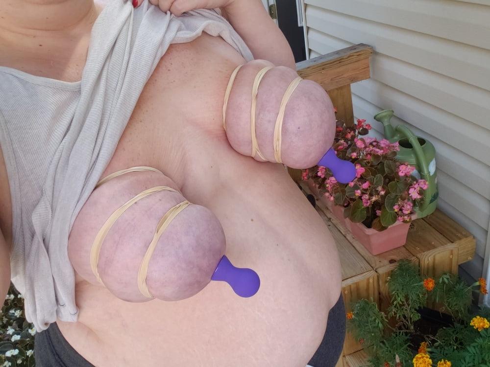 19P Bound and suctioned