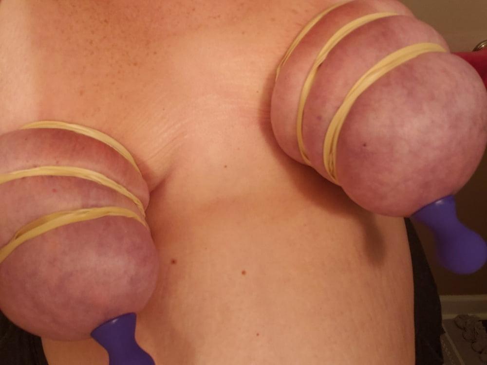 19P Bound and suctioned