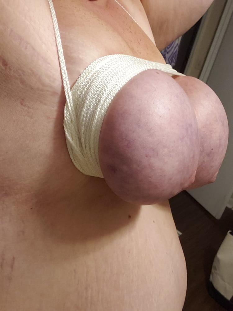19P Bound and suctioned