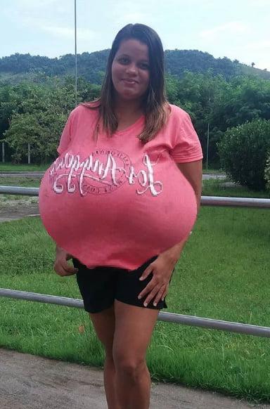 25P Extreme Breast morph