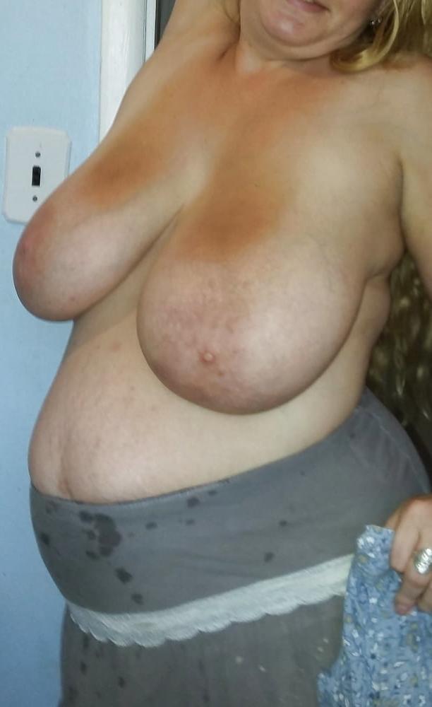 25P The Pregnant Form