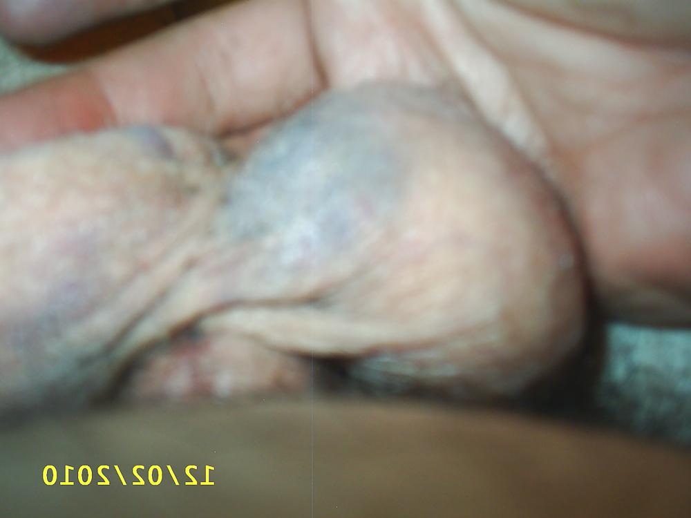 5P Spanked balls