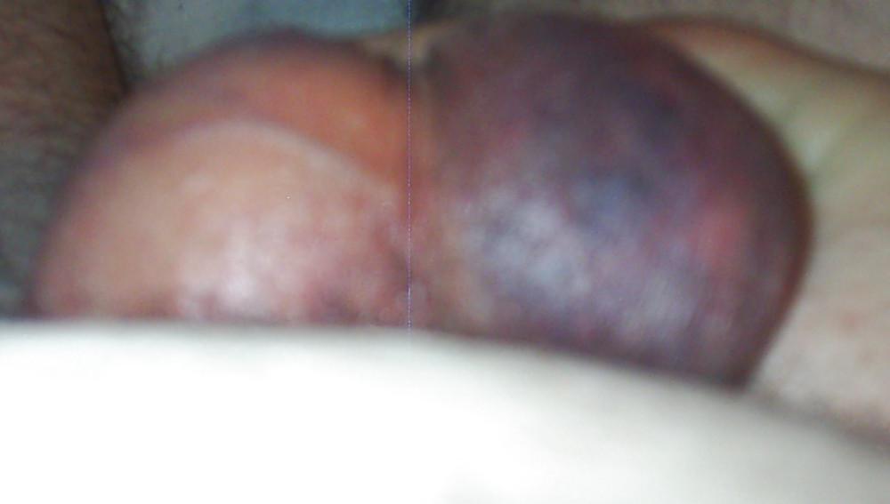5P Spanked balls