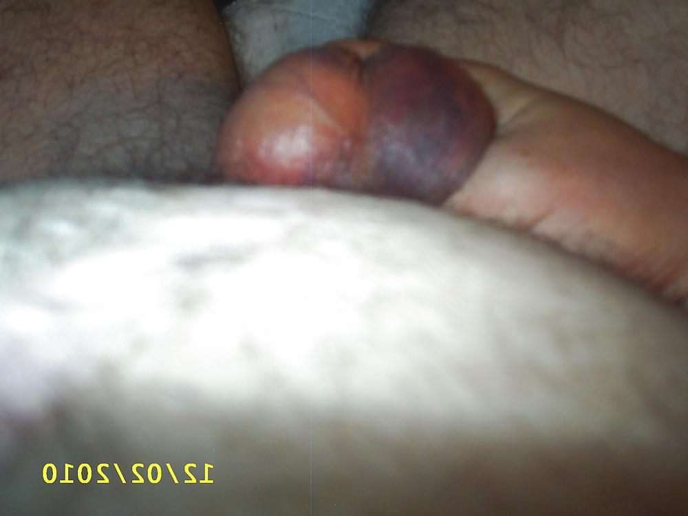 5P Spanked balls