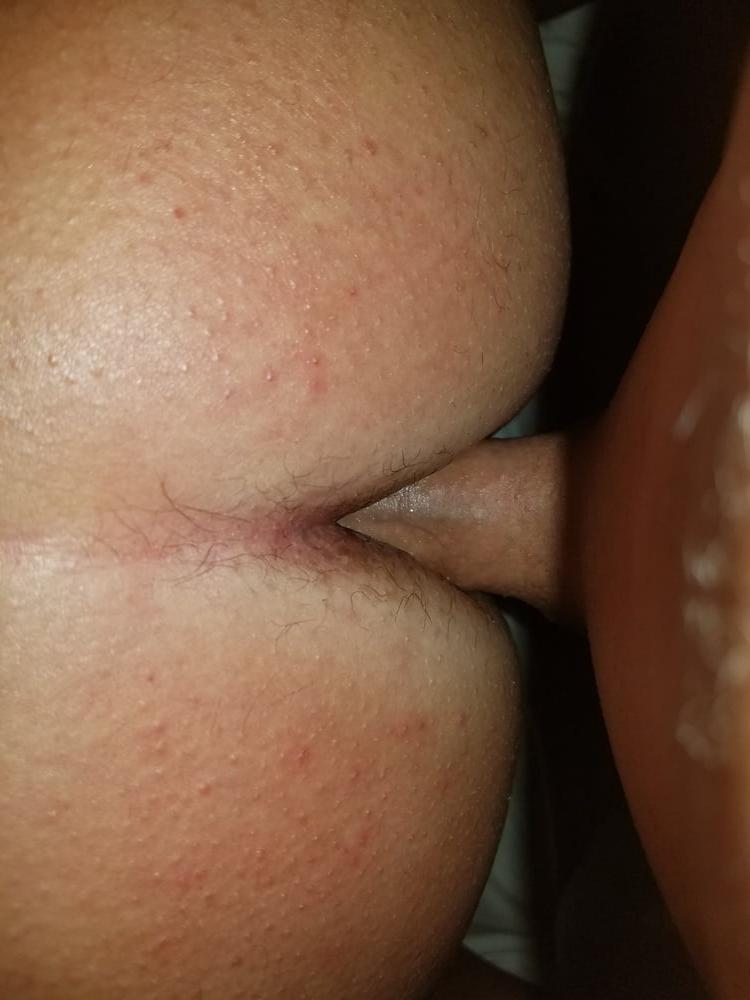5P Tilly anal